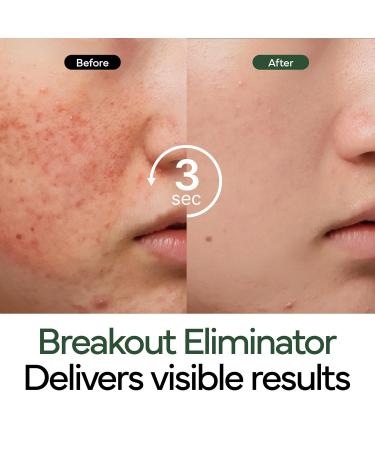 Intensive Cica Repair Cream Korean Dexpanthenol cream Ultra-Soothing & Hydrating Care Cream for Sensitive Skin with Madecassoside (1.76oz / 50g) - Buy Online on GoSupps.com