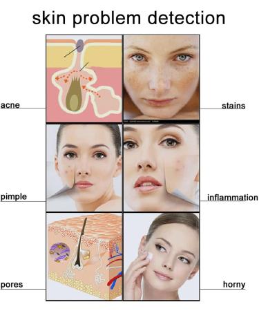 5 Inch Skin Analyzer Machine 50/200X Charging Scalp Detector Oil Moisture Tester Digital Hair Skin Analyzer Microscope White - Buy Online on GoSupps.com