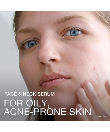 Neutrogena Stubborn Texture Niacinamide Serum Paraben Free Improve Uneven Skin Facial Exfoliator Fragrance-Free 29-mL - Buy Online on GoSupps.com