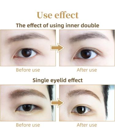 Invisible Eyelid Lifter Strips Kit Self-Adhesive Double Eyelid Tapes with Fork Rod Tweezer for Hooded Droopy Mono-eyelids 300 Pairs Eyelid Lifter Strips - Buy Online on GoSupps.com