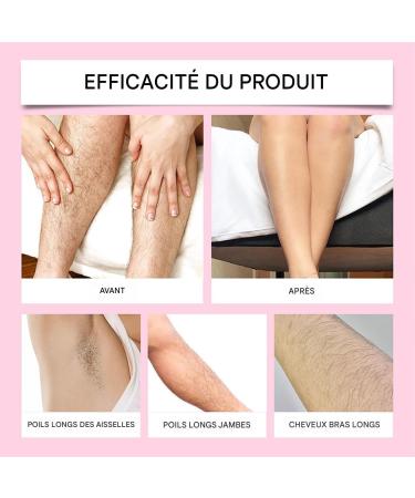  Jingmiger Epilator Spray for Men - 220ml Soothing Body Lotion | Depilatory | For Armpits Back Legs Intimate Areas and Home - Buy Online on GoSupps.com