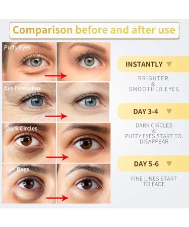 Buy 24K Gold Eye Cover - Anti-Aging Collagen & Hyaluronic Acid Treatment for Dark Circles & Wrinkles - Unisex - Buy Online on GoSupps.com