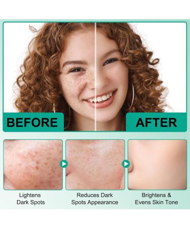 Anti Wrinkle Face Cream - Dark Spot Remover For Face - Face Moisturizer For Women - Brightening Anti Aging Face Cream With Hyaluronic Acid Retinol Niacinamide Vitamin B5 E 50ml - Buy Online on GoSupps.com