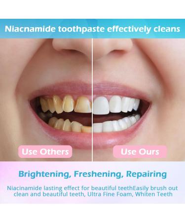 Niacinamide Whitening Toothpaste Niacinamide Toothpaste Intensive Whitens Teeth Protects Enamel Removes Stains & Refreshes Breath Daily Oral Care at Home Mint Flavor (3) 1 Ounce (Pack of 3) - Buy Online on GoSupps.com