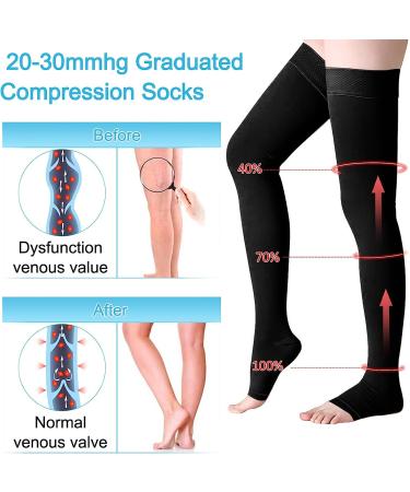 20-30 mmhg Thigh High Compression Stockings for Women Men - Open Toe Support Hose for Varicose Veins & Swelling - Black XXL (1 Pair) - Buy Online on GoSupps.com