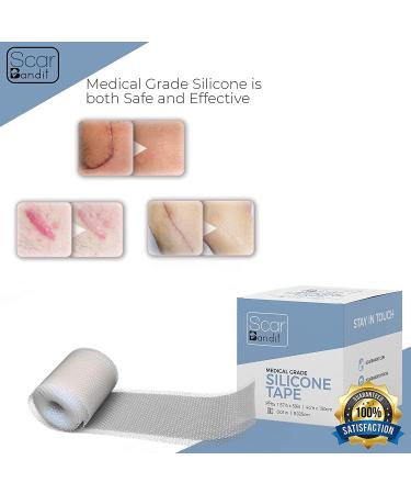 Scarbandit Silicone Scar Sheets - Scars Removal Treatment - Tummy Tuck & C-Section Recovery - 1.57x59 Inch (Pack of 1) - Buy Online on GoSupps.com