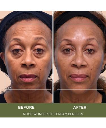 Noor Wonder Lift Cream for Women Natural Anti-Aging Wrinkle teatment with Syn-Ake natural blend Promotes Anti Aging and Significantly Less Wrinkles In As Little As A Few Days - Buy Online on GoSupps.com