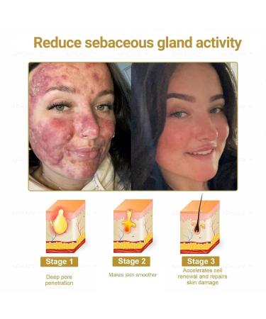 Luhaka Effective All-in-One Skin Cream All in One Skin Bee Venom Cream Bee Venom Cream Effectively solve various skin problems (1) - Buy Online on GoSupps.com