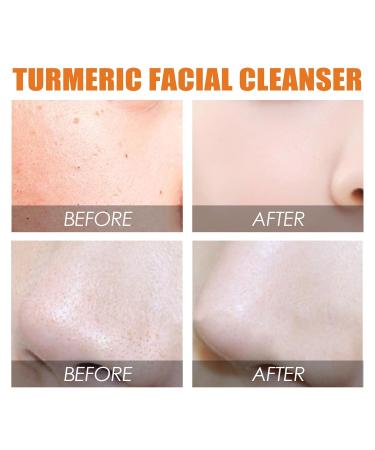 Facial Cleanser - Deep Cleansing & Skin Barrier Repair Hydrating Brightening Pore Tightening For Smooth Radiant(1PCS) - Buy Online on GoSupps.com