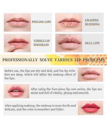 LSxia Honey Milk Lip Care Kit - 4 Piece Set for Moisturizing & Nourishing Dry Lips | Overnight Lip Exfoliator, Repair, and Hydration | Holiday Gift Set - Buy Online on GoSupps.com