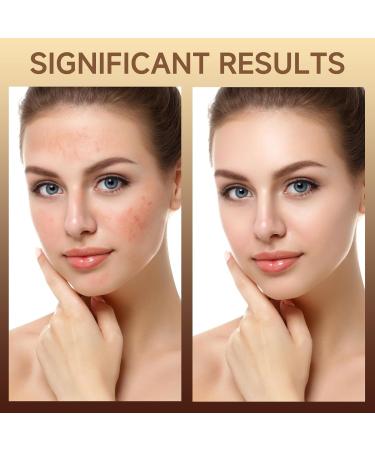 HZENPPOR PDRN Serum Cream 99% Pure Salmon DNA PDRN Advanced Face Moisturizer Cream with Collagen Hyaluronic Acid Niacinamide for Glass Glow Skin Hydration Uneven Skin Tone 20g Unscented - Buy Online on GoSupps.com