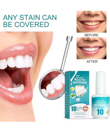 Teeth Paint Teeth Whitening Gel Teeth Whitening Paint Instant Whitening Paint for Teeth Teeth Polish White for Sensitive Teeth (1 - Buy Online on GoSupps.com