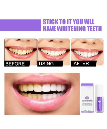 Whitening Toothpaste for Skin & Teeth | Deep Cleansing & Stain Removal | 30ml International Shipping - Buy Online on GoSupps.com