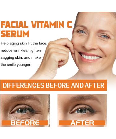 Anti Aging Face Serum For Women Over 50: Niacinamide Vibrance Vitamin C Caffeine Bakuchiol Brightening Hydrating Lifting Wrinkle & Age Spots Reduction - Buy Online on GoSupps.com
