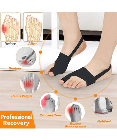 Bunion Corrector for Women & Men - Non-Surgical Bunion Splints with Toe Separators - Effective Hallux Valgus Correction - Day/Night Wear - Black - Buy Online on GoSupps.com