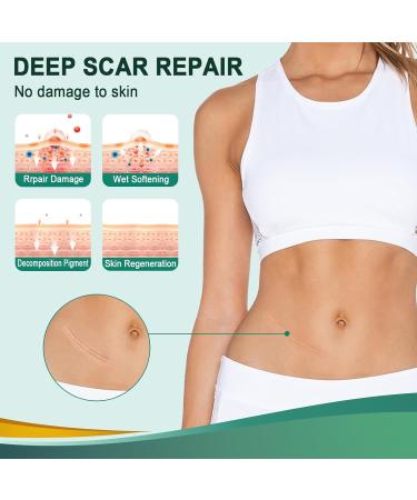 Surgical Scar Treatment Silicone Tape - Reusable Medical Grade Sheets for Keloid & Acne Scars (1.6 x 120 Roll) - Buy Online on GoSupps.com