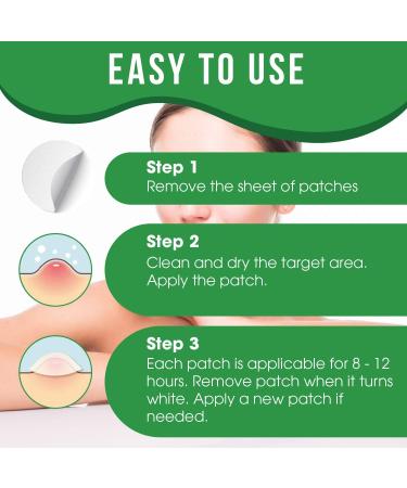 Pimple Patch Device - 72 Herbal Condensed Patches for Small to Large Pimples, Warts, and Blackheads on All Skin Types - Buy Online on GoSupps.com