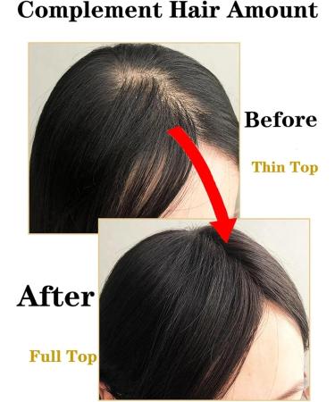 Human Hair Toppers Body Wave Silk Base Topper with Baby Hair 8-22" Chinese Remy Hair Natural Scalp Hair Piece with 4 Clips Ideal for Thinning Hair (Color : 14 inches Size : 12X13cm) 12X13cm 14 inches - Buy Online on GoSupps.com