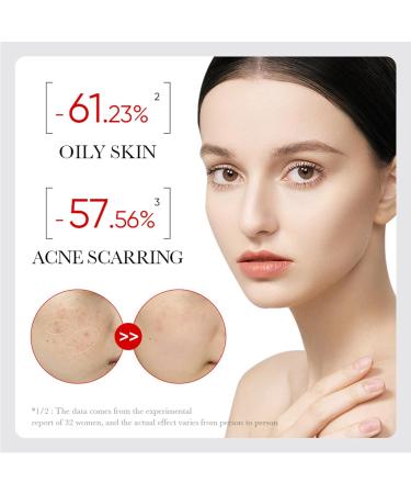 Friut Acid Face Serum for Acne Mark Salicylic Acid Anti Wrinkle Serum Fade Ance Mark & Shrink Pore Face Serum Hyaluronic Acid Acne Repair Serum for Sensitive Skin Smoothing Hyaluronic Serum-30ml - Buy Online on GoSupps.com