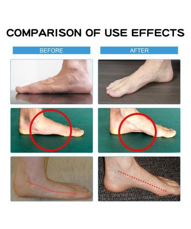 Achilles Tendon Support Band - Breathable Ankle Compression Sleeve for Men & Women | Adjustable Ankle Brace for Optimal Support - Buy Online on GoSupps.com