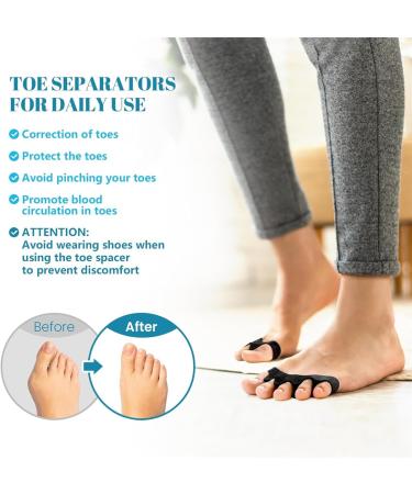 Toe Spreader & Bunion Corrector Gel - 2 Pairs Adjustable Toe Extensor for Hallux Valgus Plantar Fasciitis & Hammer Toe - Improve Toe Health - Buy Online on GoSupps.com