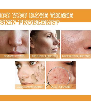 7% Glycolic Acid Toning Solution Glycolic Sour 7 Toner Glycolic Acid Toning Solution Glycolic Acid 7% Toning Resurfacing Solution Glycolic Acid Toner Glycolic Acid Hydrating Toner - Buy Online on GoSupps.com