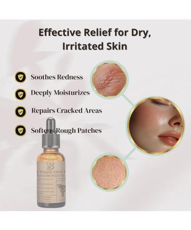 Niacinamide Serum for Face - Beef Tallow Face Serum B3 Natural Moisturizer for Dry & Sensitive Skin Anti-Aging Hydrating & Repairing Grass-Fed Tallow Skincare - Buy Online on GoSupps.com