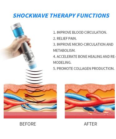 Shop Electromagnet Shock Wave Therapy Device for ED & Chronic Pain Relief - Professional Deep Tissue Body Massage in Silver - Buy Online on GoSupps.com