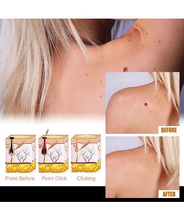 Advanced Face Corrector Serum - Gentle Tag Removal for Face and Body with Tea Tree Leaf Oil & Panthenol - Dermatologist-Tested Skin Renewal Solution - Buy Online on GoSupps.com