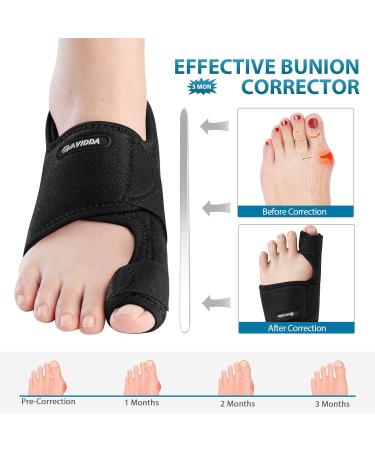AVIDDA Bunion Corrector Kit - Adjustable Toe Separators for Hallux Valgus - Bunion Pain Relief Splint for Men and Women - Day/Night Support - Buy Online on GoSupps.com