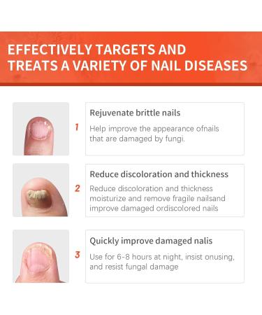Extra Strength Toenail Fungus Treatment - 32 Pcs Nighttime Renewal Patch for Fast Relief & Visible Results - Buy Online on GoSupps.com