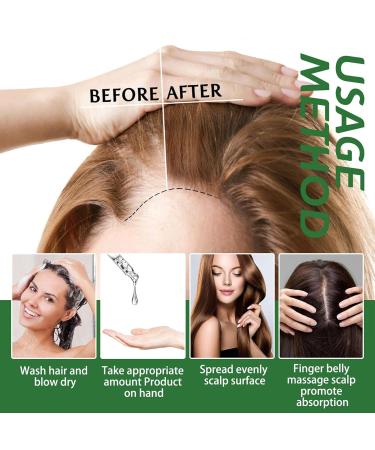 Firulab 60ml Rosemary Oil for Hair Growth and Hair Loss Refreshing Rosemary Oil for Hair Growth and Damaged Hair - Buy Online on GoSupps.com