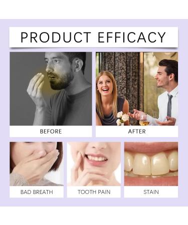 Kiss Artifact Mint Flavored Oral Freshening Spray with Vitamin B1 Gluconolactone 15ml/0.51 Fl Oz Daily Use Gentle Formula - Buy Online on GoSupps.com