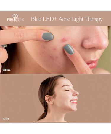 Blue LED+ Acne Light Therapy by Project E Beauty | Anti-Acne Skincare | Reduce Dark Spots & Scars | Calm Inflammation & Sensitive Skin | Remove Blemishes | For Skin Rashes & Oily Skin - Buy Online on GoSupps.com