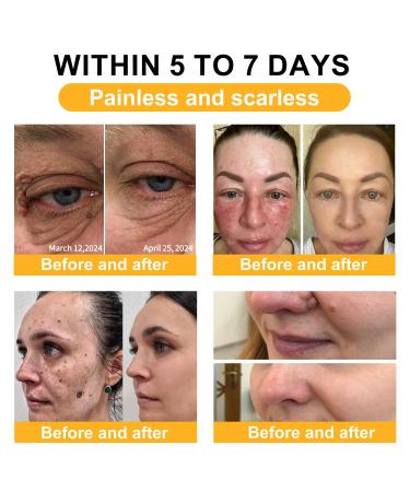 PLTOWE Powerful All-Body Skin Treatment Cream, Professional Bee Venom Skin Treatment Cream, Natural Powerful All Body Skin Treatment Cream Suitable for All Skin Types (3 Pack) - Buy Online on GoSupps.com