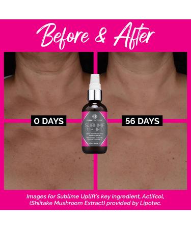 Sublime Uplift Neck Firming Serum - Anti-Aging Tightening Cream for Wrinkles & Crepey Skin on Neck Chest & D collet with Shiitake Extract Hyaluronic Acid & Peptides - Shop Internationally - Buy Online on GoSupps.com