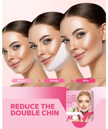 FairyFace V Line Shaping Face Masks - 5 Count Double Chin Reducer and Anti-Aging Hydrogel Collagen Mask with Aloe Vera and Seaweed - Anti-Wrinkle Lifting Treatment - Buy Online on GoSupps.com