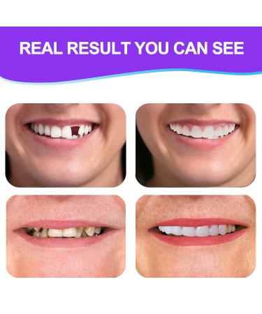 Nature Comfort Fake Teeth Set: Upper & Lower Dentures for Confident Smile - White (2 PCS) - Buy Online on GoSupps.com