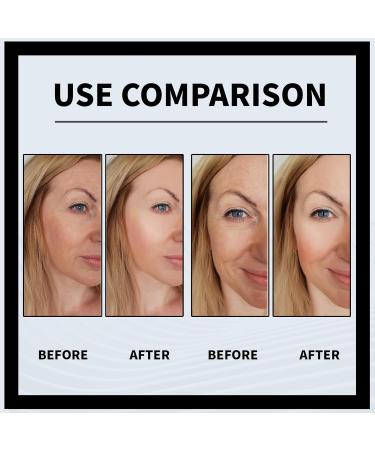 Alpha Arbutin 2% + Hyaluronic Acid Serum For Acne 30ML Alpha Arbutin 2% Ha Face Serum For Fine Lines & Wrinkle Moisturizing Hyaluronic Acid Serum For Women. 1 - Buy Online on GoSupps.com