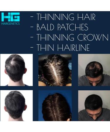 Dark Brown Hair Genetics Hair Fibres - 50g Hair Loss Treatment with Hair Fibers - Buy Online on GoSupps.com