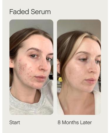 Topicals Faded Starter Kit - Brightening & Clearing Bundle | Faded Serum for Dark Spots & Under Eye Masks - Buy Online on GoSupps.com