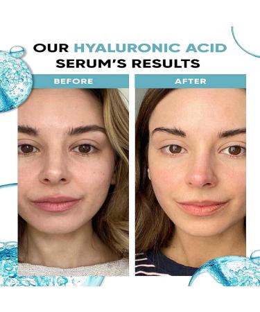 Hyaluronic Acid 2%+B5 Face Serum Hyaluronic Acid Serum for Face Hyaluronic Acid Serum Skincare Moisturiser Face Brightening Serum Face Serum for Women to Smooth Skin Anti Aging Serum for Face - Buy Online on GoSupps.com