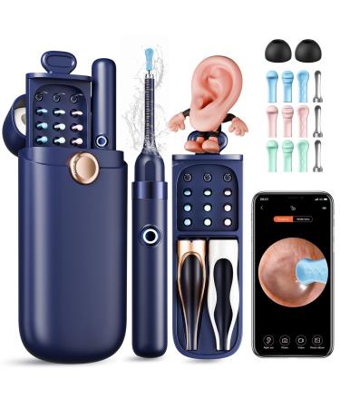 Ear Wax Removal Ear Cleaner with Camera 1296P HD Visual Ear Cleaner with 6 LED Lights and Flexible Tip FSA HSA Eligible Items Safe Ear Wax Removal Kit with Camera Ear Cleaning Tool for Family Gifts Black