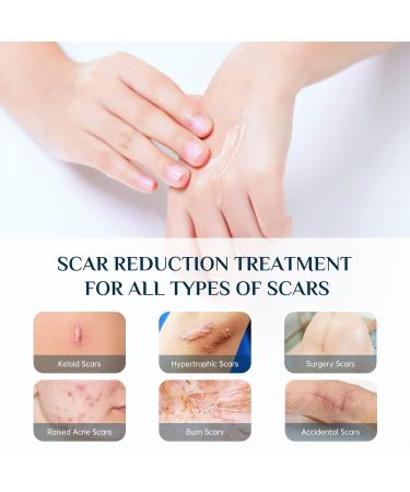 Mebak Silicone Scar Gel - Scar Therapy for Old and New Scars - 30g - Buy Online on GoSupps.com