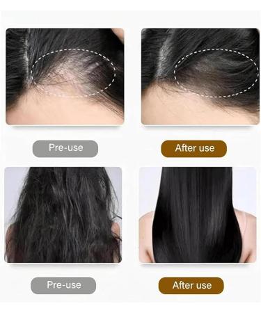 COALHO Antihair Loss Shampoo Antihair Loss and Hair Growth Shampoo Hair Thickening Shampoo for Men & Women Promote Hair Growth Anti hair Loss Shampoo 3pcs - Buy Online on GoSupps.com