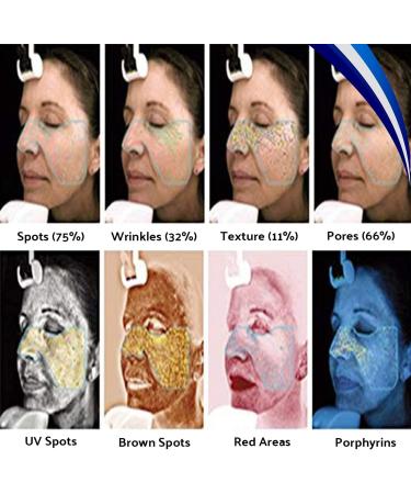 Lnober Skin Health Detection Wood Lamp - Portable & Multifunctional Skin Disease Identifier - Buy Online on GoSupps.com