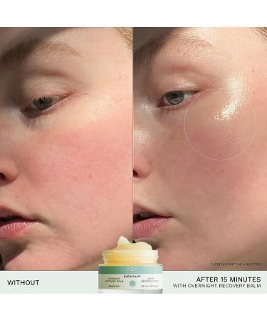 REN Clean Skincare Evercalm Overnight Recovery Balm - Skin Barrier Protection for Rosacea & Sensitive Skin - 1 Fl Oz - Buy Online on GoSupps.com