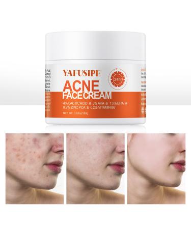 Acne Treatment for Face  Salicylic Acid Acne Cream Back Acne Treatment Cream for Teens & Adults Anti-acne Moisturizer Pimple Cream Butt Acne Clearing Cream  Acne Spot Treatment for Breakouts Blemish