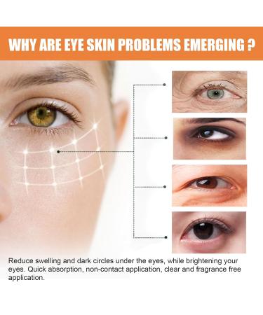 Vitamin C Eye Balm for Dark Circles - Retinol Eye Serum | Hydrating Eye Treatment (1pcs - Buy Online on GoSupps.com