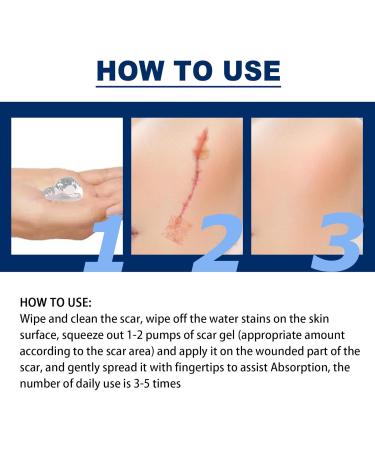 Silicone Scar Gel - Scar Cream - 30g Scar Removal - Scar Treatment - Scar Gel for Surgical Scars C-Section Stretch Marks Acne Injury Burns Old and New Scars - Buy Online on GoSupps.com